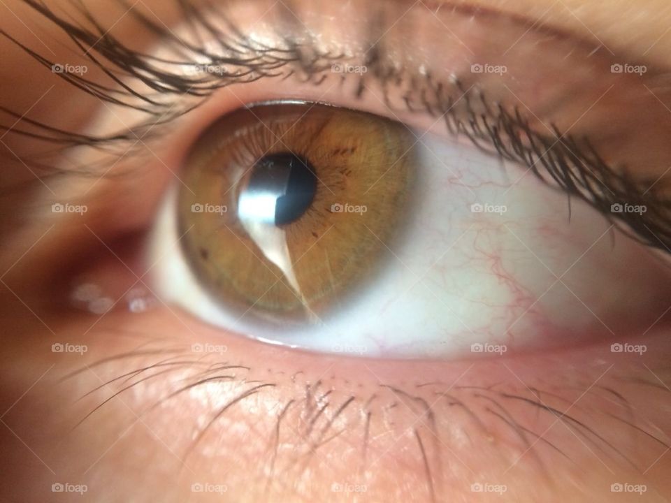 Eye