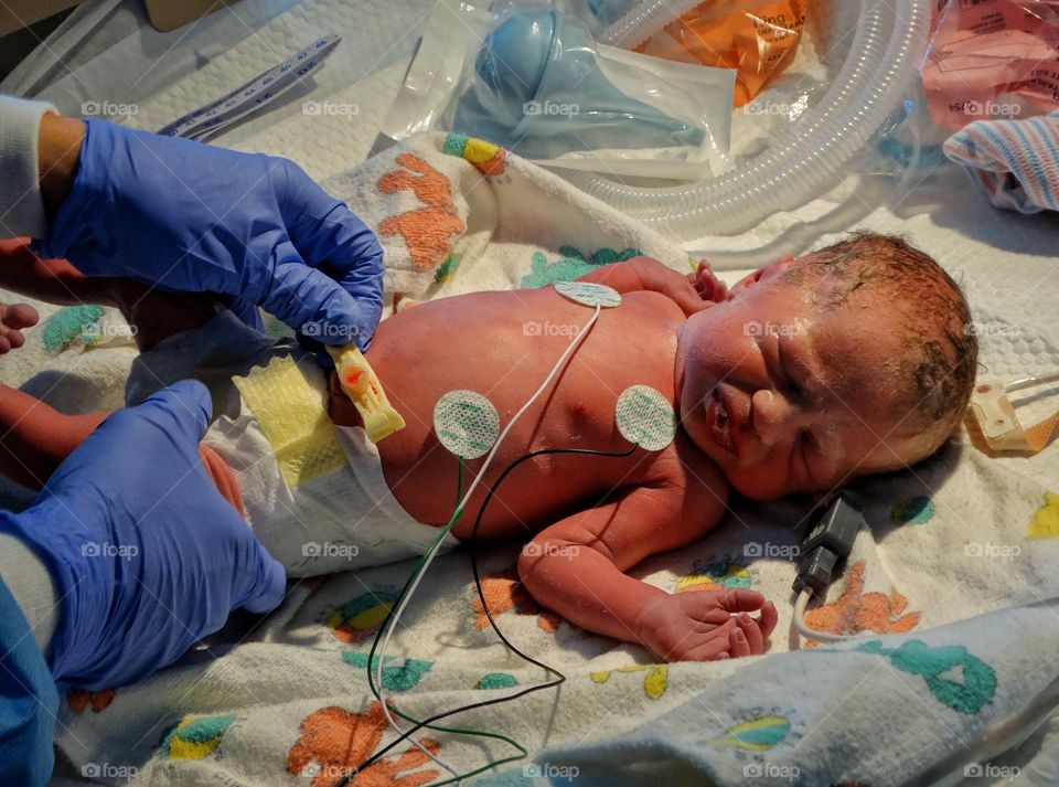 Newborn Premature Infant
