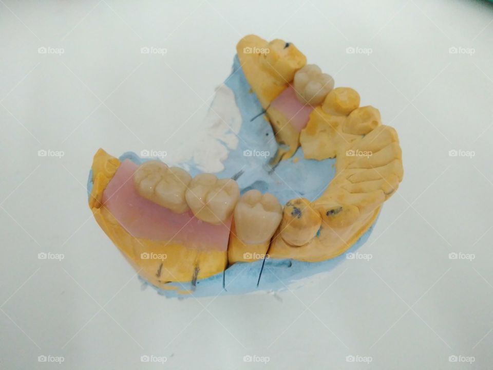 Dental