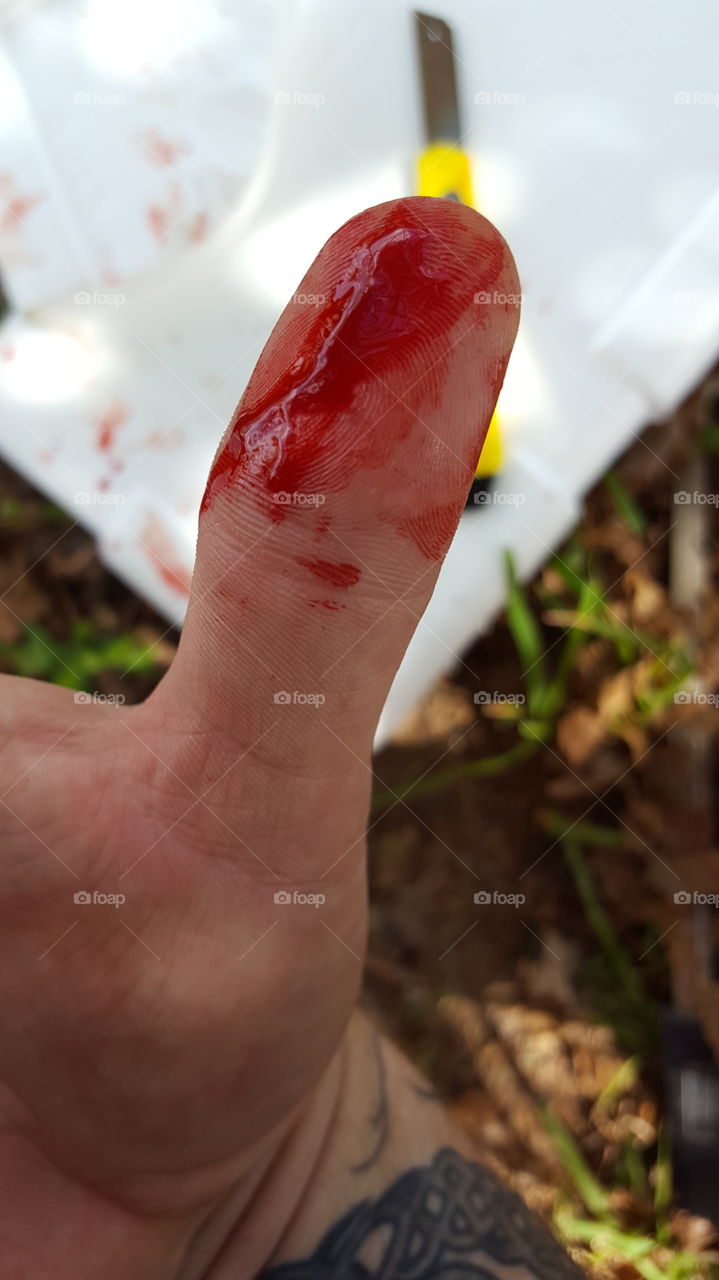 Accident with blade, bleeding finger