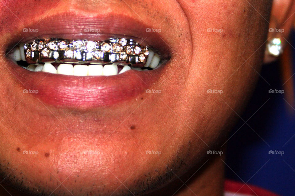 teeth grill artist dentist by habitforming