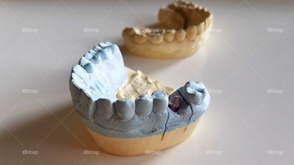 Dental impressions