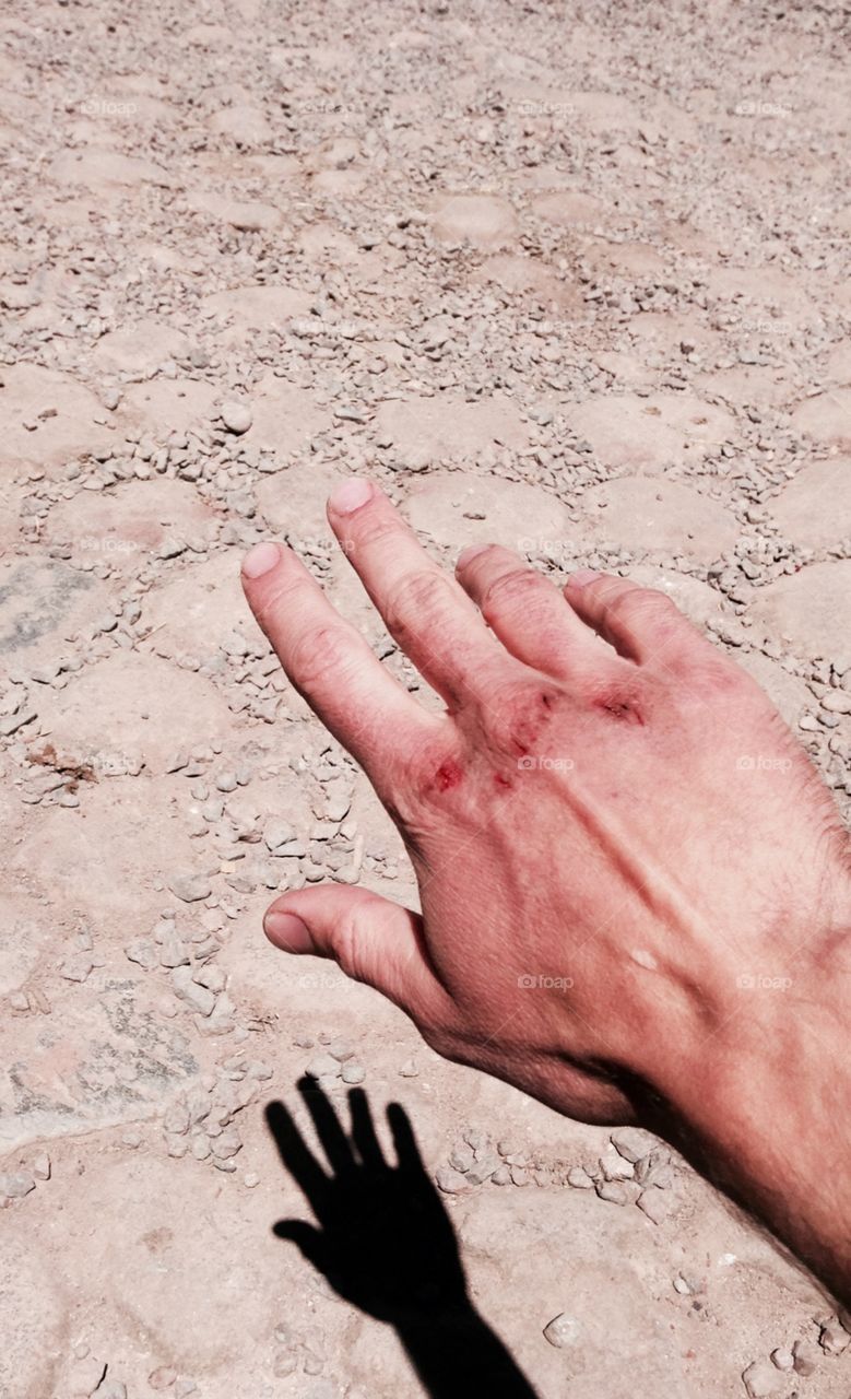 Bloody hands in dry desert. This what the sun, dust, wind and desert cold could do to your hands in one week.