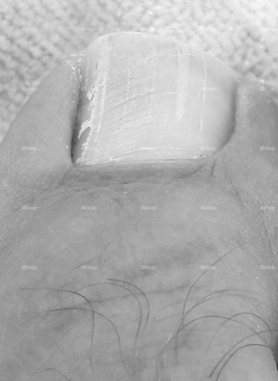 oh! there is a nail on my feet!