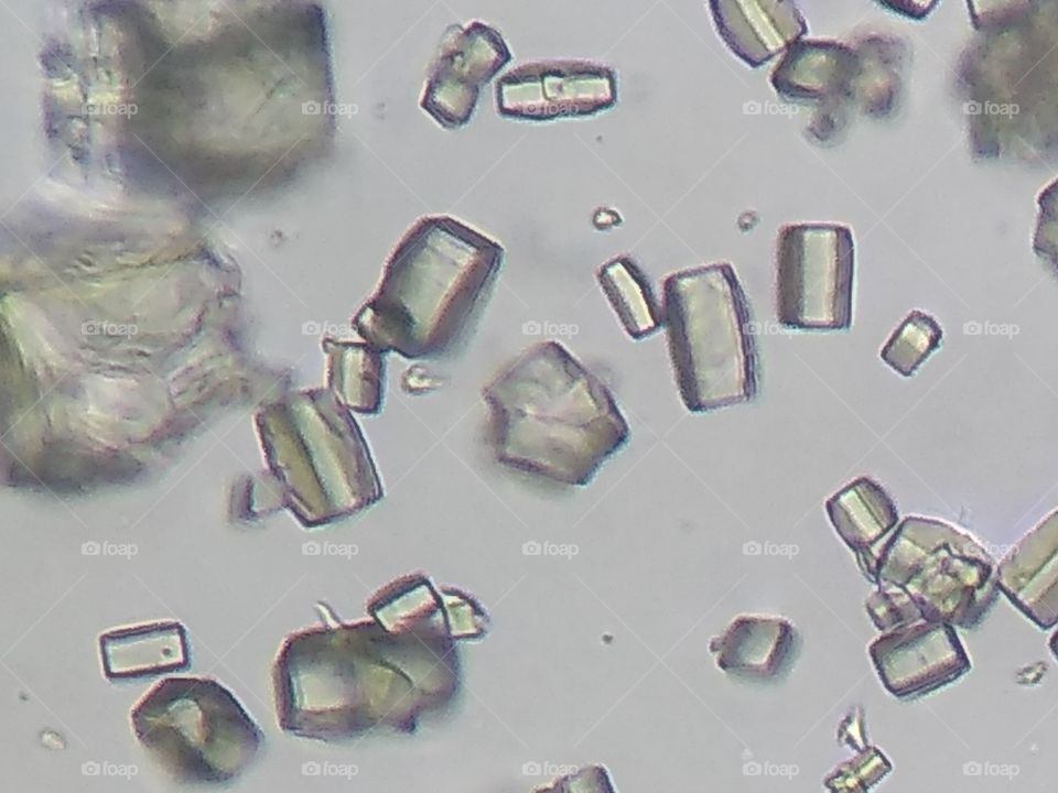 cristales de triple fosfato