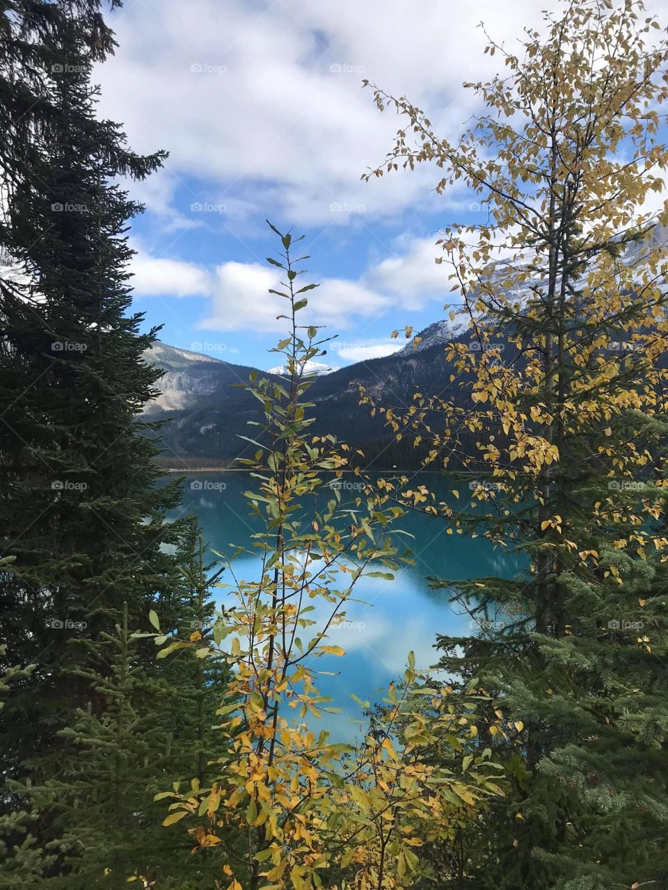 Emerald Lake and Trees